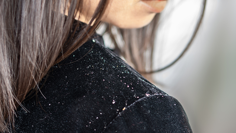 How-to-choose-your-anti-dandruff-product