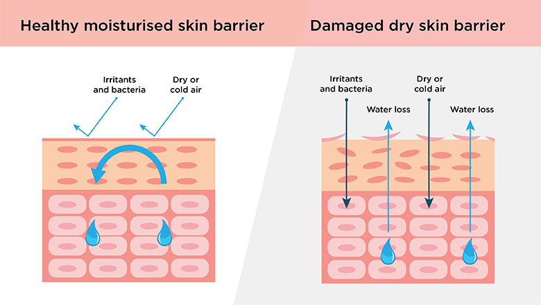 dehydrated skin 2